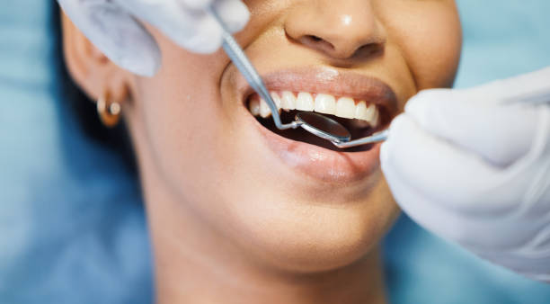 Best Broken or Cracked Tooth Emergency Dentist in Sherwood, OR